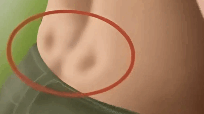 echete-dyo-lakkakia-sto-kato-meros-tis-platis-sas-deite-ti-simainei-408653