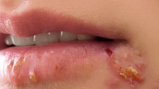 an-deite-ayto-na-emfanizetai-sta-cheili-sas-einai-simadi-oti-400769