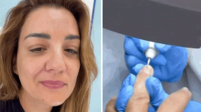 peripeteia-ygeias-gia-tin-papila-ola-xekinisan-otan-archisa-na-vlepo-sta-nychia-moy-kati-mikres-grammes-403661