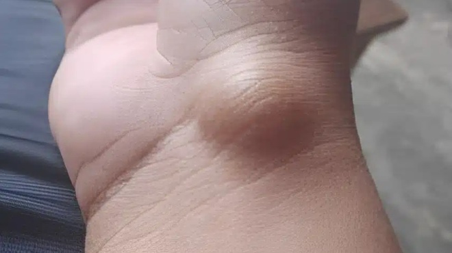 ayto-to-exogkoma-mporei-na-emfanistei-logo-kati-poy-kanete-kathe-mera-amp-8230-402141