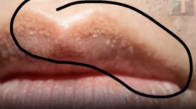 giati-mporei-na-deite-asynithista-leyka-ozidia-sta-cheili-i-sta-gennntika-sas-opgana-402151