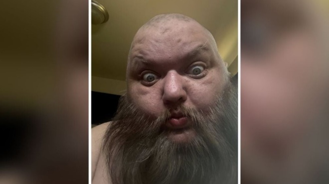 eidisi-sok-pethane-pasignostos-tik-toker-eiche-provlima-ygeias-kai-kaneis-den-ixere-tipota-amp-8211-matheytike-to-onoma-toy-405469