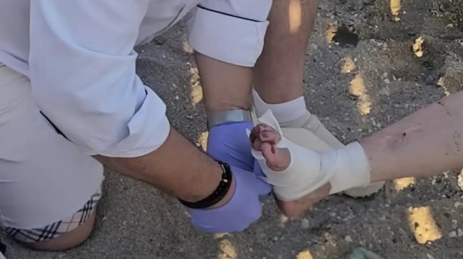 tpomos-se-paralia-tis-attikis-thalassia-chelona-ekopse-dachtylo-gynaikas-kai-epitethike-se-alloys-dyo-loyomenoys-400913