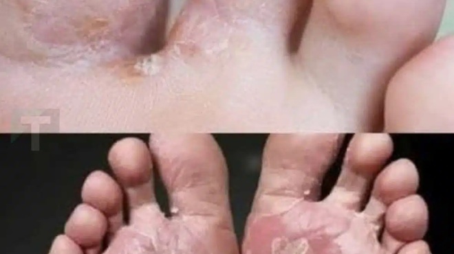 proeidopoiisi-an-to-echete-ayto-sta-podia-sas-mporei-na-einai-simadi-416976