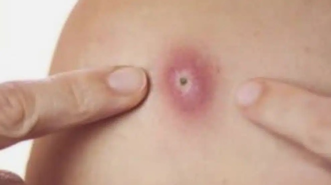 prosochi-ayta-einai-xekathara-simadia-oti-ayto-einai-410399