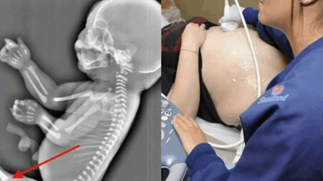 egkyos-pairnei-tin-apofasi-na-kanei-ektrosi-otan-vlepei-ston-ypericho-oti-to-moro-tis-tha-sokaristeite-412534