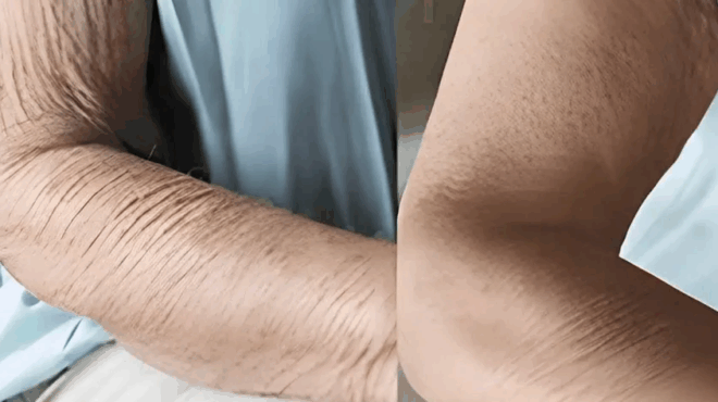 pos-na-frontisete-to-derma-poy-gernaei-413617