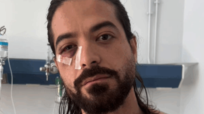 tora-ektakti-eidisi-gia-ton-ari-moygkopetro-413844