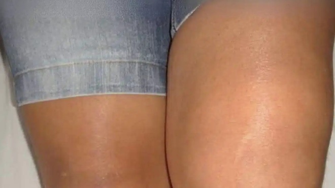 giati-to-ena-gonato-einai-prismeno-alla-ochi-to-allo-414129