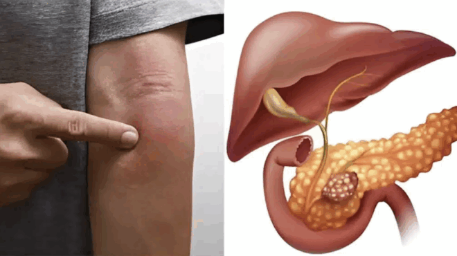 to-periergo-simadi-sto-derma-poy-deichnei-karkino-sto-pagkreas-grigora-gia-exetaseis-415205