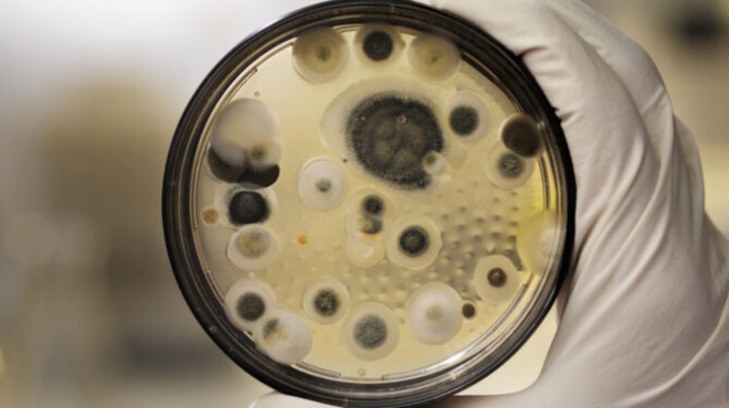 epikindynos-mykitas-exaplonetai-sta-ellinika-nosokomeia-stin-5ada-me-ta-perissotera-kroysmata-stin-ee-i-chora-mas-411797