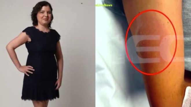 ektakto-marissa-laimoy-amp-8211-ayti-einai-i-episimi-aitia-thavatoy-amp-8211-ti-epathe-telika-meta-to-tsimpima-415977