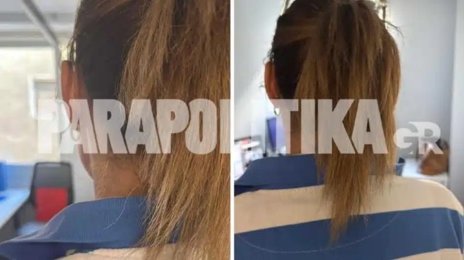 sok-epivatis-leoforeioy-ekopse-me-psalidi-to-malli-anypopsiastis-gynaikas-425097