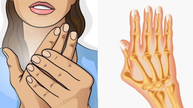 reymatoeidis-arthritida-ta-synithi-symptomata-ti-na-trote-kai-ti-na-apofeygete-420538