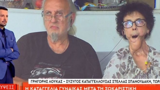 kataggelia-gia-giatro-se-elliniko-nosokomeio-paramorfose-gynaika-poy-nikise-karkino-sti-glossa-den-mporei-na-milisei-i-na-faei-421948