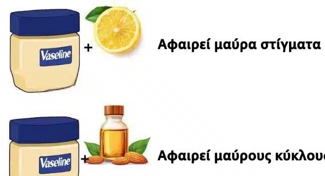 oi-perissoteroi-chanoyn-ayta-ta-10-koryfaia-kolpa-me-vazelini-423099