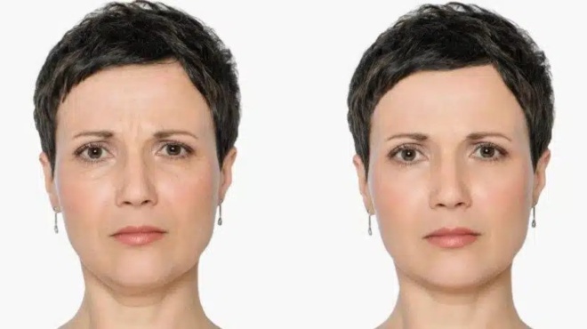 klimaktirios-11-symvoyles-ton-eidikon-gia-na-diatirisete-ti-neotita-sas-kata-ti-diarkeia-tis-emminopaysis-423417