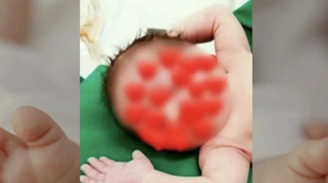 larisa-pos-epese-to-kayto-ladi-pano-sto-somataki-toy-18-minon-vrefoys-poy-meta-epathe-anakopi-425224