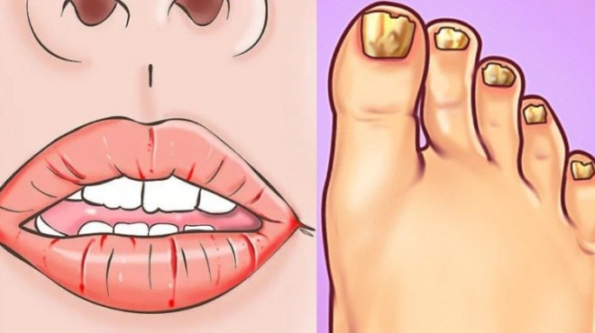 19-kampanakia-poy-chtypaei-to-soma-soy-otan-kati-den-paei-kala-me-tin-ygeia-soy-420597