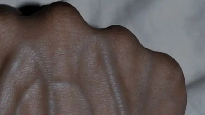 5-provlimata-ygeias-poy-mporoyn-na-prokalesoyn-orates-fleves-421840