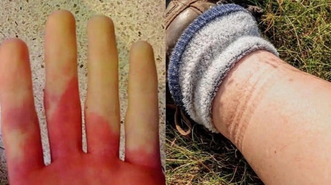 anakopi-kardias-ti-tha-niosete-meres-prin-sas-symvei-6-symptomata-poy-prepei-na-anagnorisete-egkairos-423115