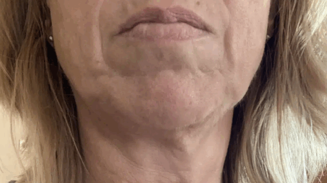 endokrinologos-apokalyptei-ta-dyo-fagita-poy-kanoyn-to-derma-na-gerna-pio-grigora-427528