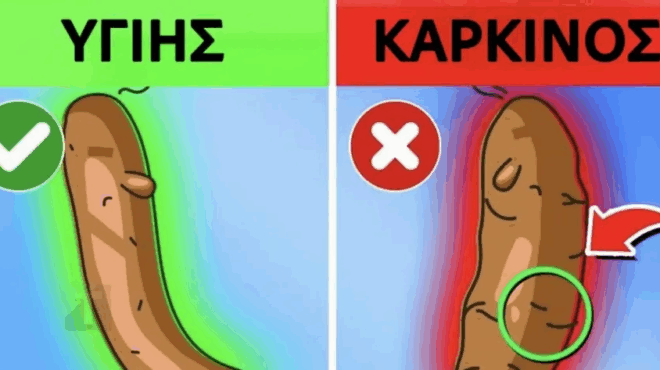 ti-apokalyptei-to-chroma-ton-kopranon-sas-gia-tin-ygeia-sas-429950