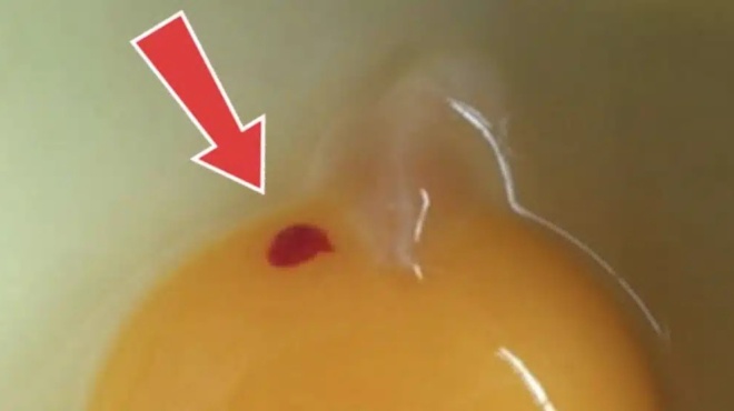 prepei-na-trome-ayga-me-kilides-aimatos-430124