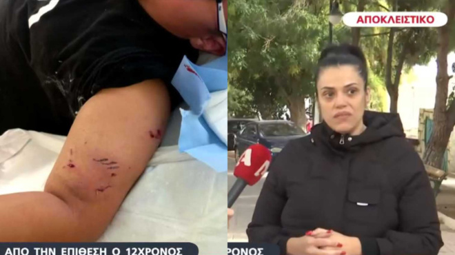 skylos-dagkose-12chrono-exo-apo-dimotiko-scholeio-ti-katiggeile-i-mitera-toy-gia-ton-idioktiti-432797