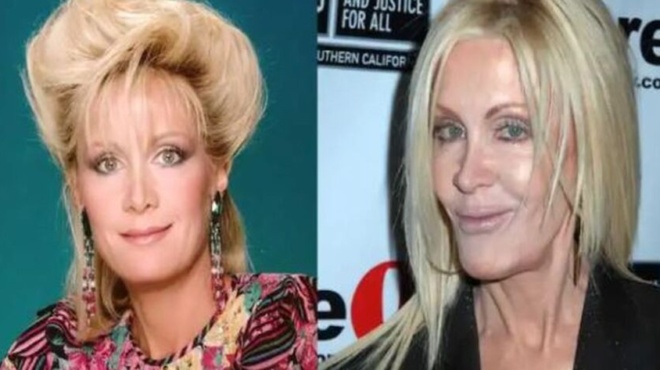 paramorfothike-apo-tis-plastikes-moiazei-me-moymia-pasignosti-star-egine-agnoristi-apo-ti-mataiodoxia-433782