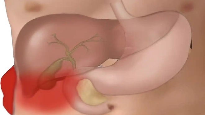 to-fapmako-toy-ftochoy-i-pamfthini-trofi-gia-ena-ygies-entero-427880