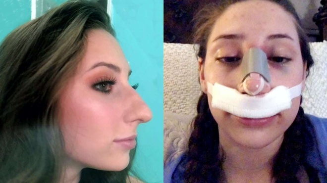 gennithike-me-megali-myti-tin-fonazan-gynaika-amp-8211-ramfos-alla-ekane-egcheirisi-kai-egine-pio-omorfi-apo-montelo-442502