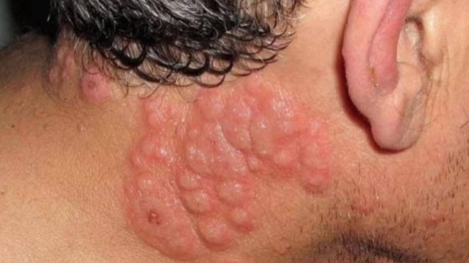 aytes-einai-oi-synepeies-toy-na-koimasai-me-435335