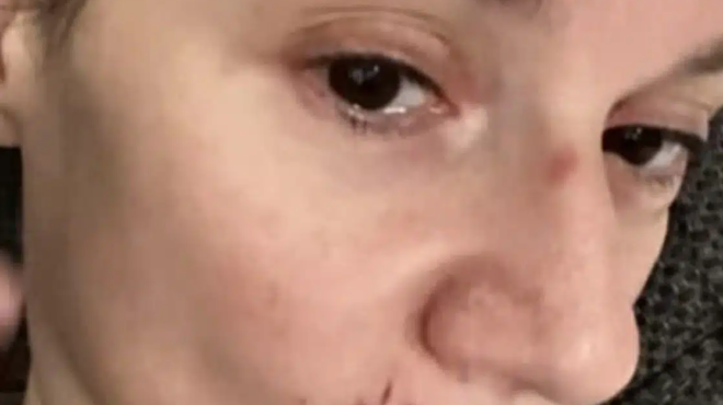 me-mayrismeno-mati-kai-me-aimata-sto-prosopo-i-pegky-trikalioti-441720