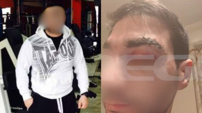 ektakto-nekros-o-mpoxer-poy-xylokopise-ton-giatro-mesa-sto-nosokomeio-438601