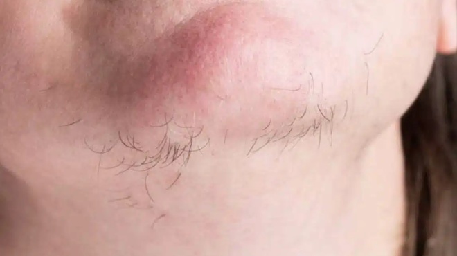 ti-mporei-na-sas-lene-oi-triches-toy-pigoynioy-gia-tin-ygeia-sas-439970