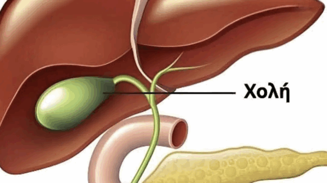 ti-symvainei-sto-soma-meta-tin-afairesi-tis-cholidochoy-kystis-3-astheneies-poy-mporei-na-akoloythisoyn-apofygete-ti-cheiroyrgiki-epemvasi-ean-einai-dynaton-435241