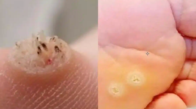 na-eiste-poly-prosektikoi-an-paratirisete-ayto-mporei-na-simainei-oti-echete-molynthei-apo-amp-8230-437007