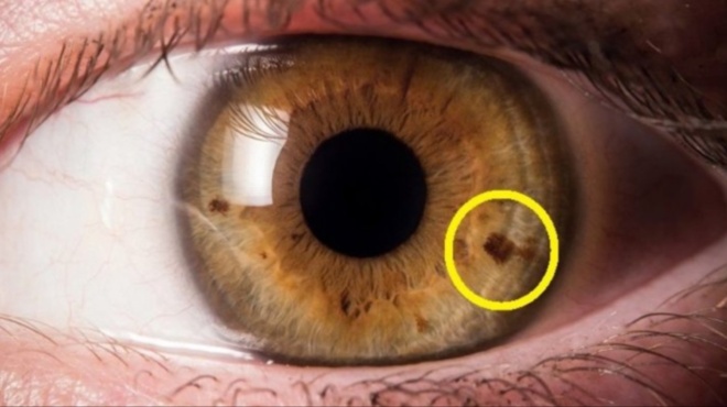 esy-to-echeis-paratirisei-ston-kathrepti-soy-yparchei-ena-simadi-sto-mati-poy-mporei-na-deichnei-oti-tha-emfaniseis-argotera-anoia-amp-8211-des-poio-443160