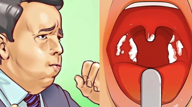 echete-synechos-vlenna-ston-laimo-ayto-simainei-ti-tin-prokalei-kai-pote-prepei-na-sas-anisychei-444907