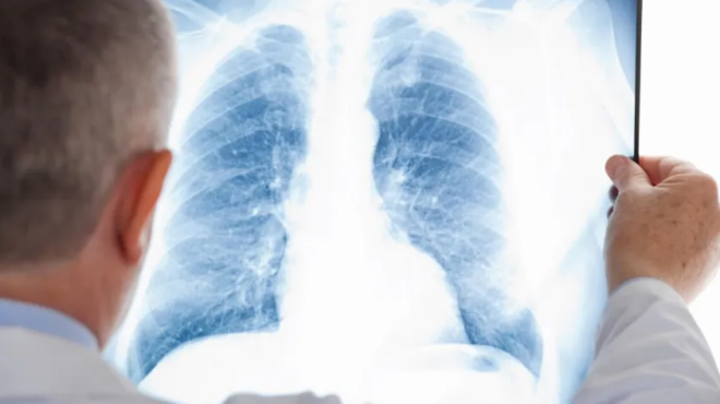 gripi-a-otan-o-ios-metakomizei-stoys-pneymones-ta-krisima-simadia-poy-deichnoyn-pneymonia-447063