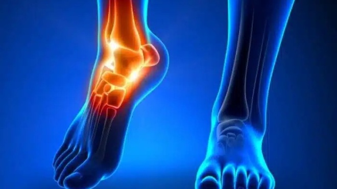 o-chymos-poy-dialyei-to-oyriko-oxy-stis-arthroseis-445188