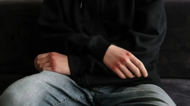 ektakti-eidisi-tora-me-15chrono-kai-16chrono-poy-sokarei-tin-ellada-445037