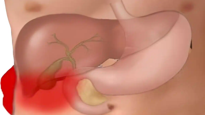 to-fapmako-toy-ftochoy-i-pamfthini-trofi-gia-ena-ygies-entero-amp-8211-valte-to-sti-diatrofi-sas-446076