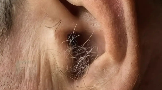 to-gnorizate-an-fytronoyn-triches-sta-aytia-sas-ayto-symvainei-epeidi-to-soma-sas-457328