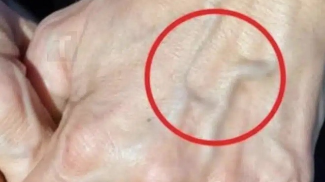 an-echete-orates-fleves-simainei-oti-eiste-amp-8230-453073