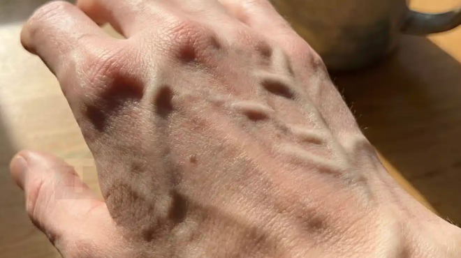 o-chartis-tis-anthropinis-kykloforias-kai-oi-viologikoi-paragontes-poy-diamorfonoyn-tin-oratotita-toy-aggeiakoy-diktyoy-456210