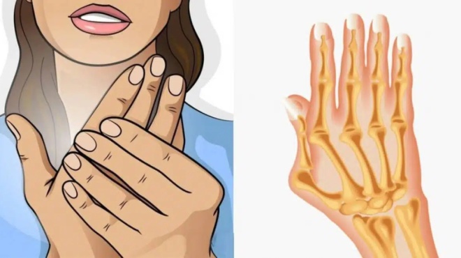 reymatoeidis-arthritida-ta-synithi-symptomata-ti-na-trote-kai-ti-na-apofeygete-453697