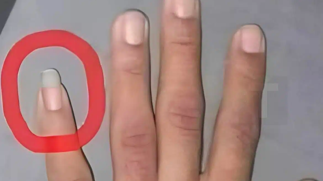 giati-merikoi-antres-afinoyn-to-nychi-toy-mikroy-dachtyloy-makry-451711