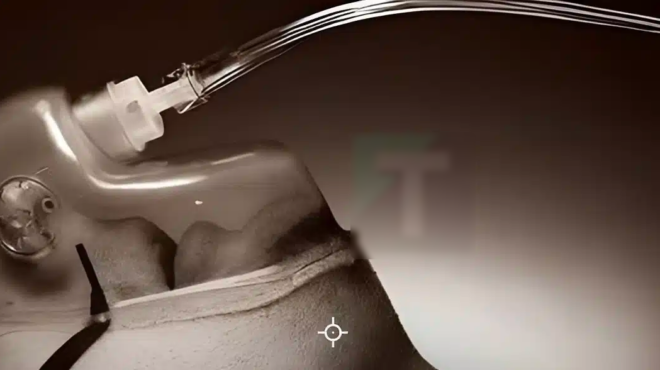 to-soma-xerei-pote-plisiazei-o-thanatos-kai-xekina-apo-ti-myti-451911